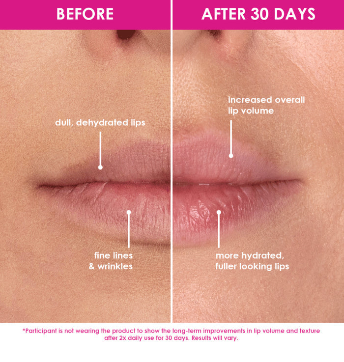 GrandeLIPS Hydrating Lip Plumper | Gloss